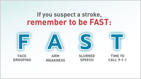 How to Prevent a Stroke - Peripheral Vascular Associates