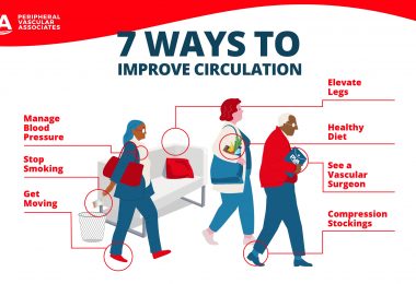 7 Ways to Improve Circulation in Legs and Feet - Periperal Vascular Associates