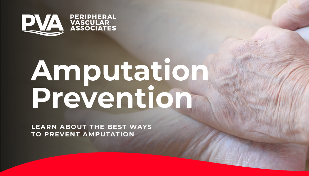 Amputation Prevention learn about the best ways to prevent Amputation - Peripheral Vascular Associates