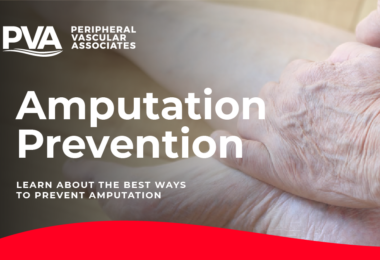 Amputation Prevention learn about the best ways to prevent Amputation - Periperal Vascular Associates