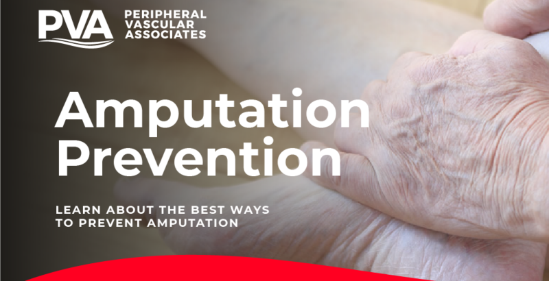 Amputation Prevention learn about the best ways to prevent Amputation - Peripheral Vascular Associates